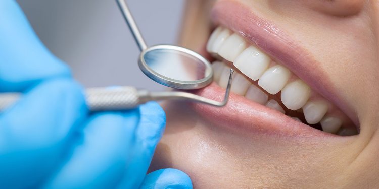 Why it's important to visit the dentist regularly