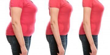 Reasons to Consider Body Contouring