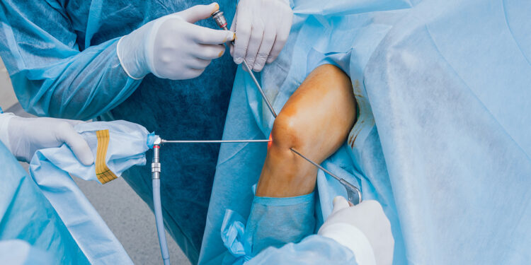 What is Knee Arthroscopy and What Does It Involve